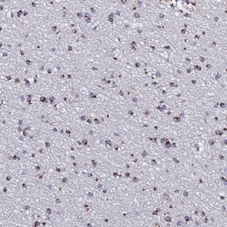 MEF2BNB Antibody, Novus Biologicals 0.1mL; Unlabeled:Antibodies, Polyclonal